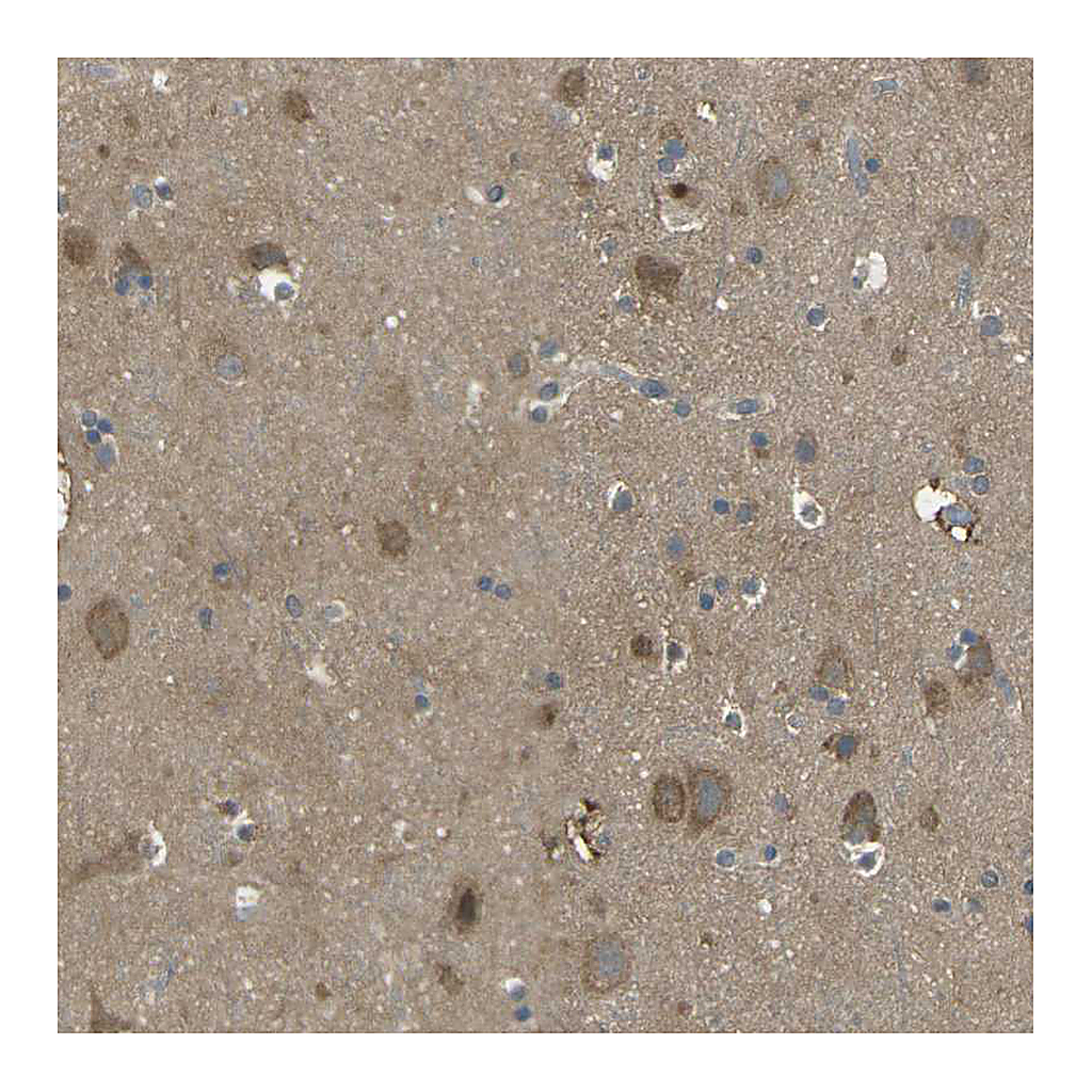 Atlas Antibodies Anti-PIEZO2 Antibody
