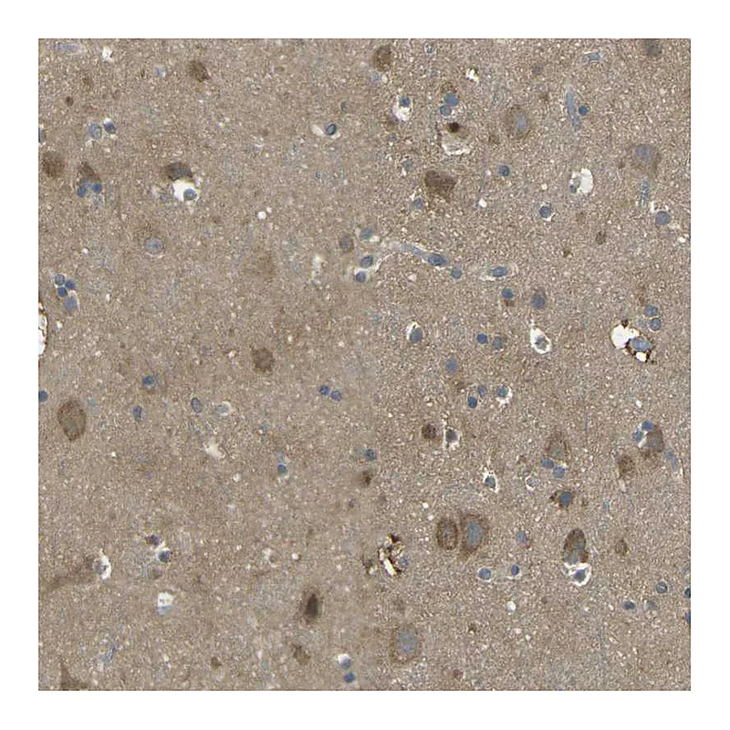Atlas Antibodies Anti-PIEZO2 Antibody