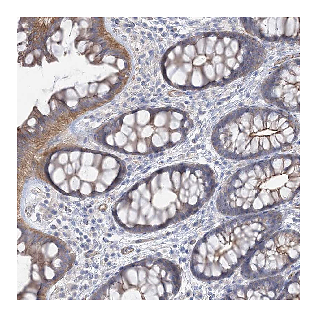 Atlas Antibodies Anti-PIGC Antibody