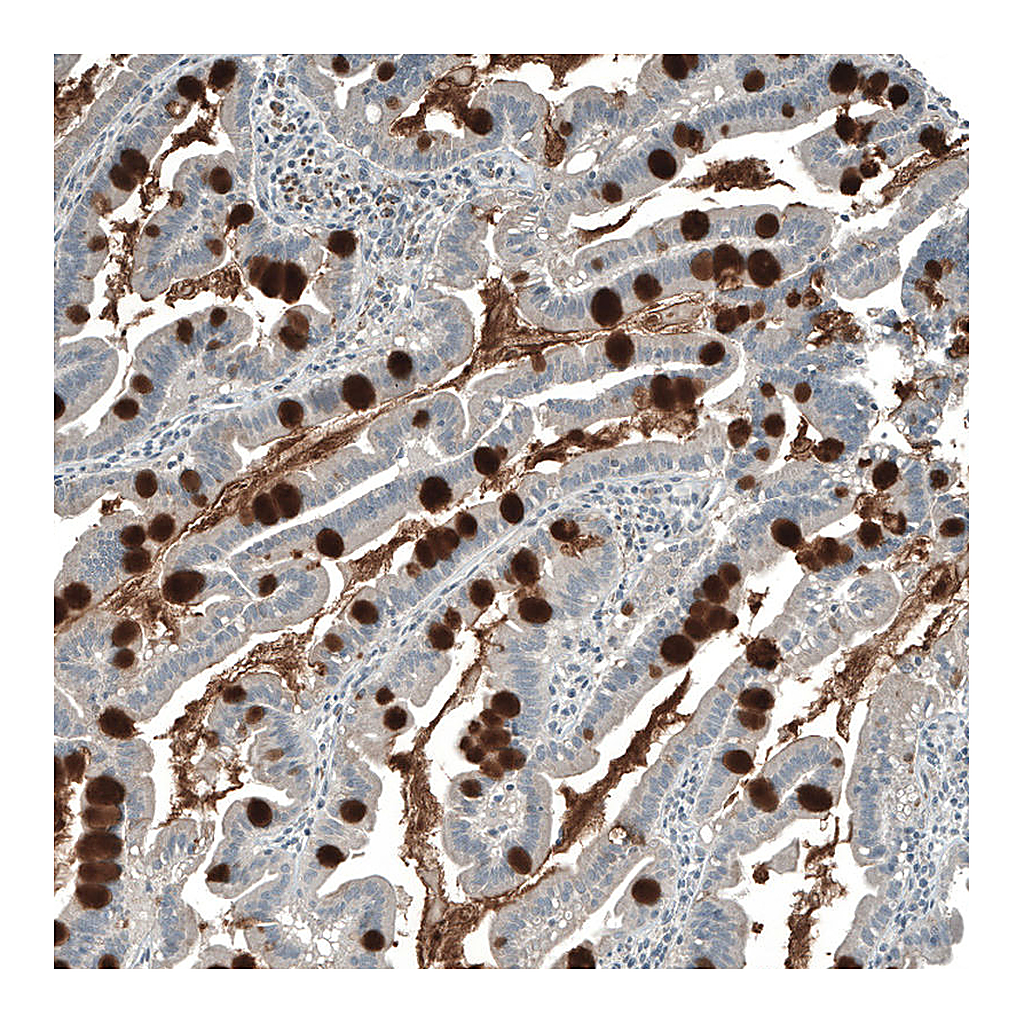 Atlas Antibodies Anti-PIGA Antibody