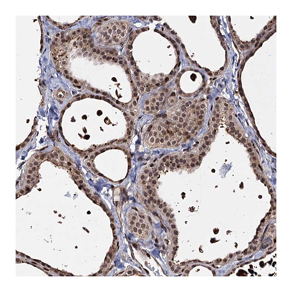 Atlas Antibodies Anti-PIGB Antibody