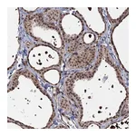 Atlas Antibodies Anti-PIGB Antibody