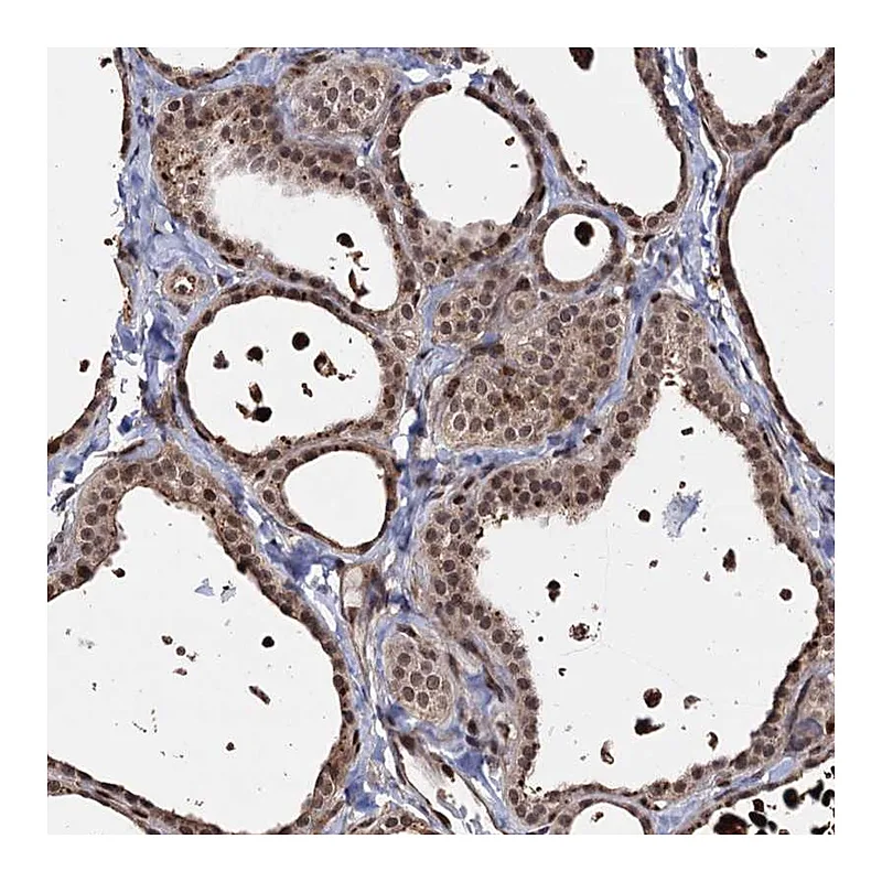 Atlas Antibodies Anti-PIGB Antibody