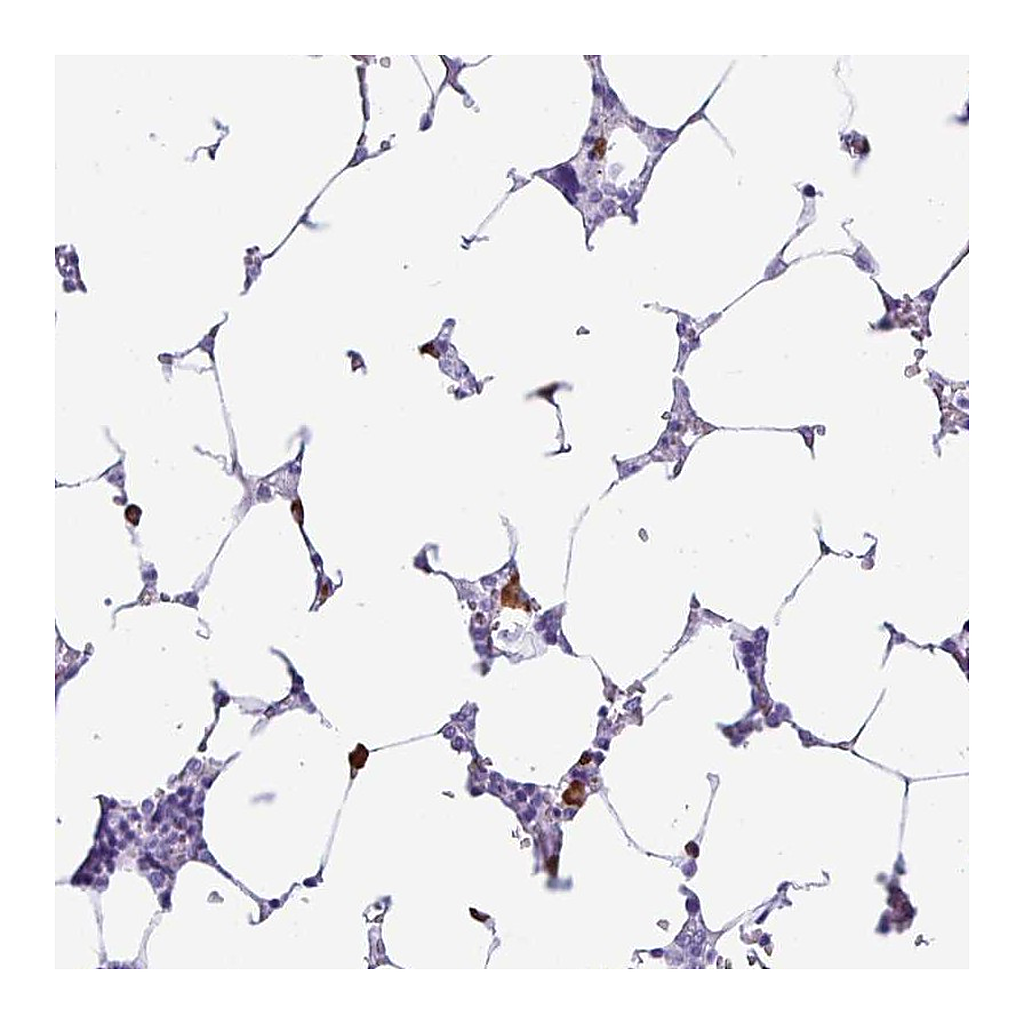 Atlas Antibodies Anti-PIGF Antibody