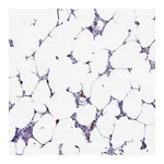 Atlas Antibodies Anti-PIGF Antibody