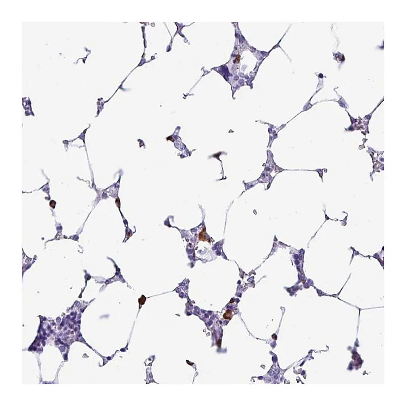 Atlas Antibodies Anti-PIGF Antibody