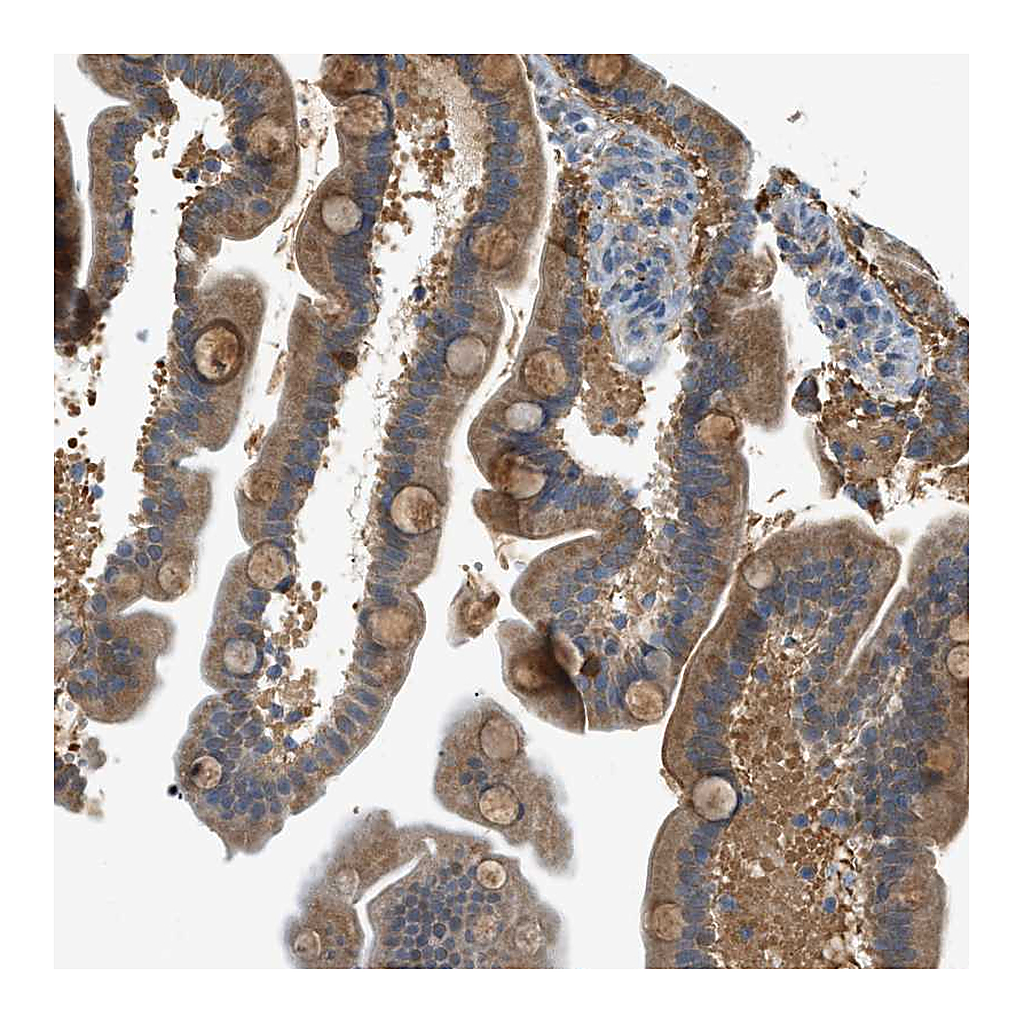 Atlas Antibodies Anti-PIGG Antibody