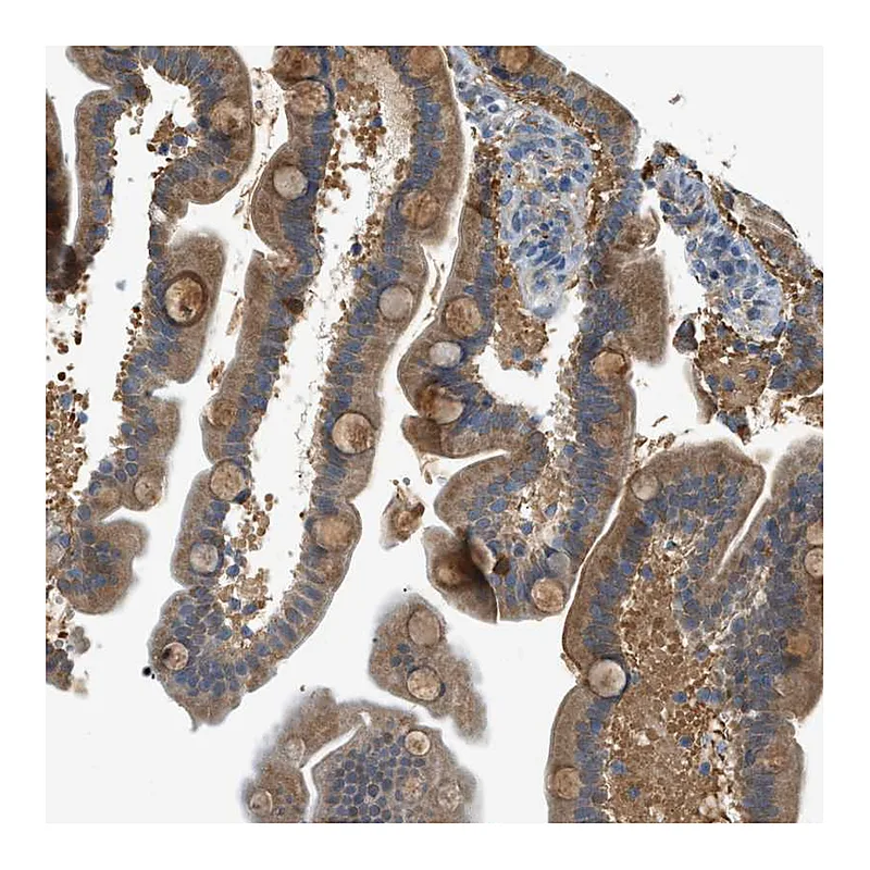 Atlas Antibodies Anti-PIGG Antibody