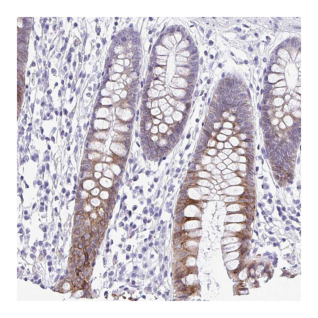 Atlas Antibodies Anti-PIGK Antibody