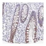 Atlas Antibodies Anti-PIGK Antibody
