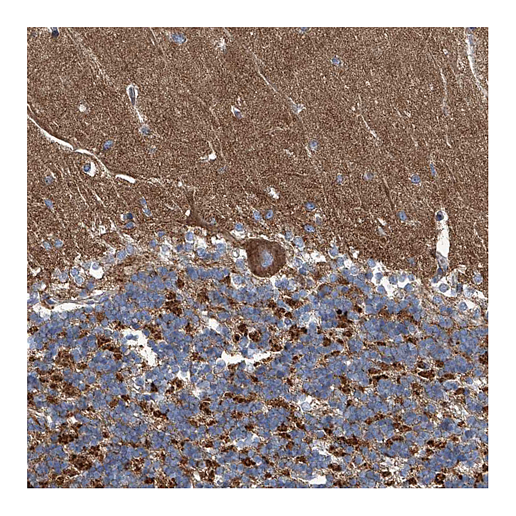 Atlas Antibodies Anti-PIGH Antibody