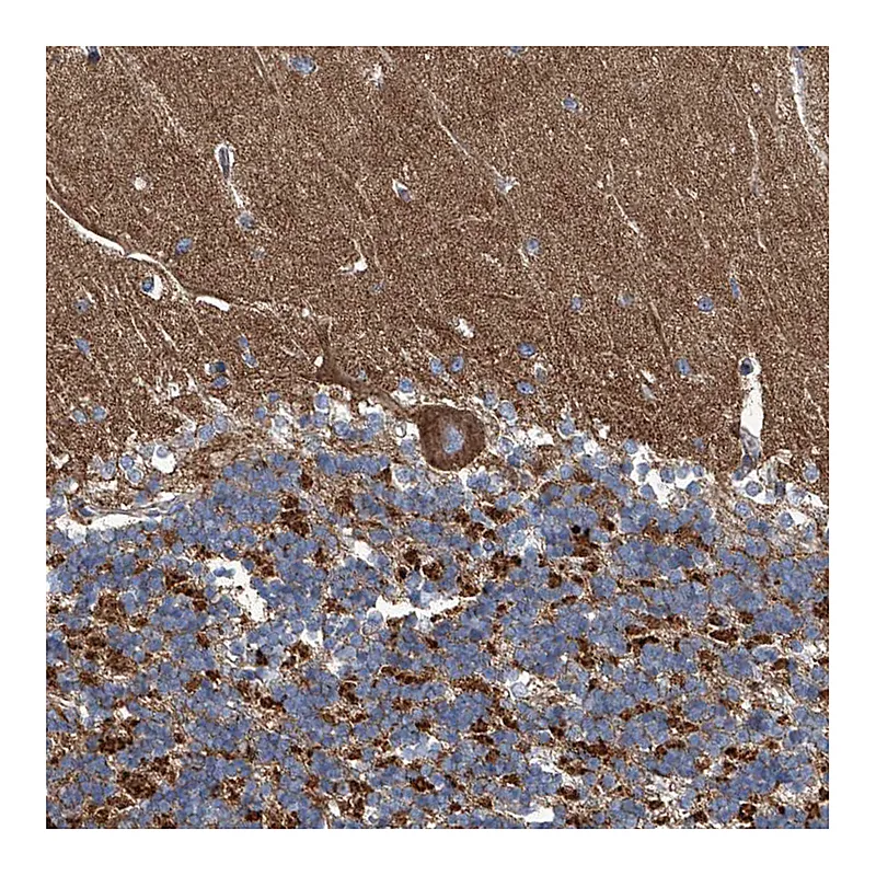 Atlas Antibodies Anti-PIGH Antibody