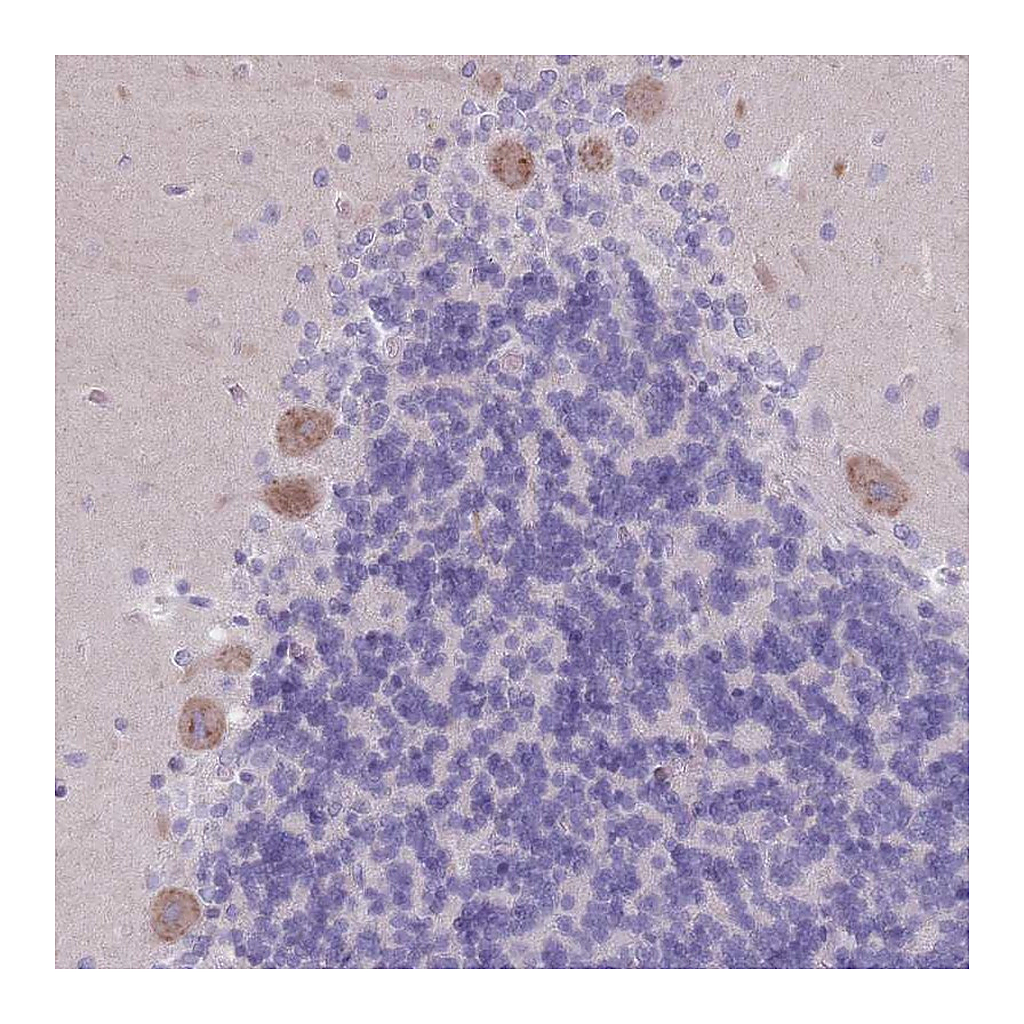 Atlas Antibodies Anti-PIGM Antibody