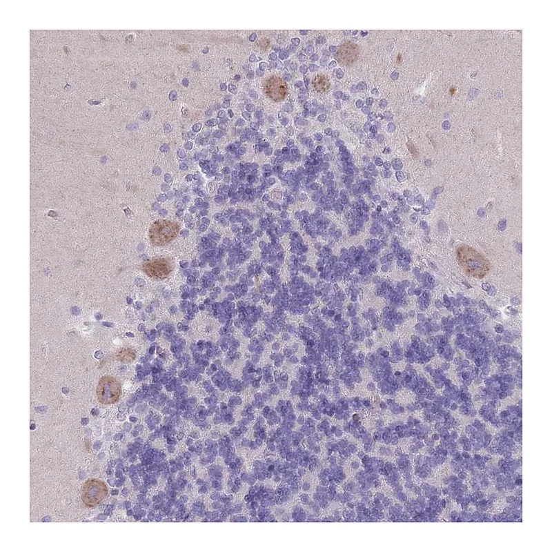 Atlas Antibodies Anti-PIGM Antibody