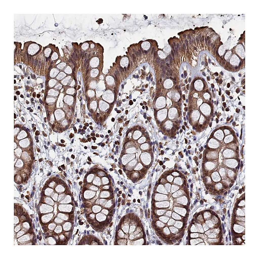 Atlas Antibodies Anti-PIGN Antibody