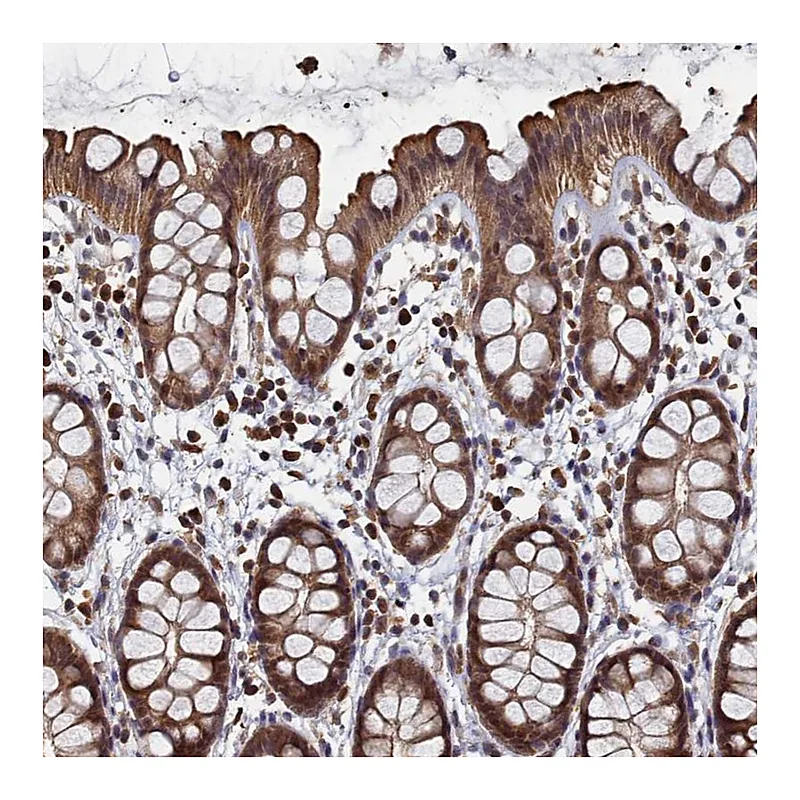 Atlas Antibodies Anti-PIGN Antibody