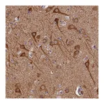Atlas Antibodies Anti-PIGQ Antibody