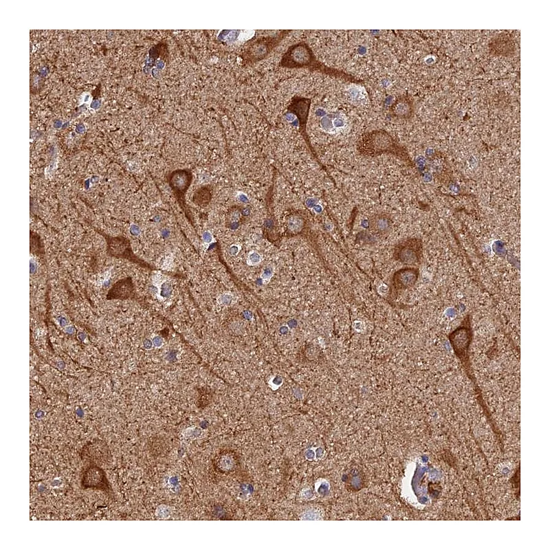Atlas Antibodies Anti-PIGQ Antibody