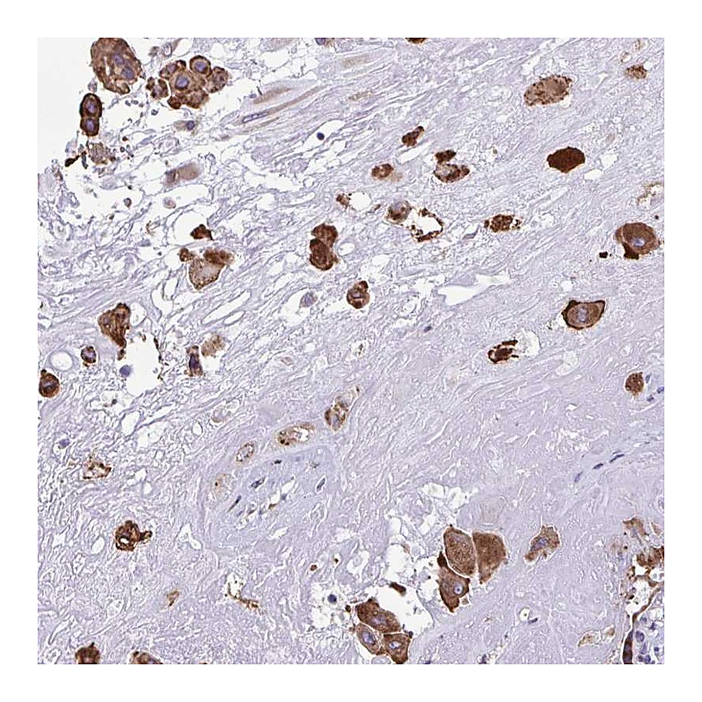 Atlas Antibodies Anti-PIGK Antibody
