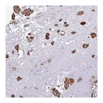 Atlas Antibodies Anti-PIGK Antibody
