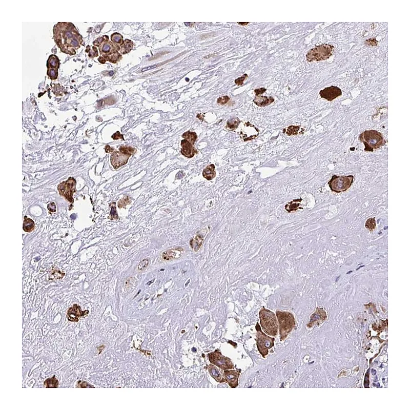 Atlas Antibodies Anti-PIGK Antibody