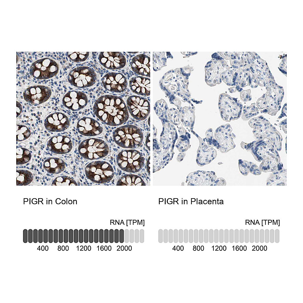Atlas Antibodies Anti-PIGR Antibody