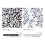 Atlas Antibodies Anti-PIGR Antibody