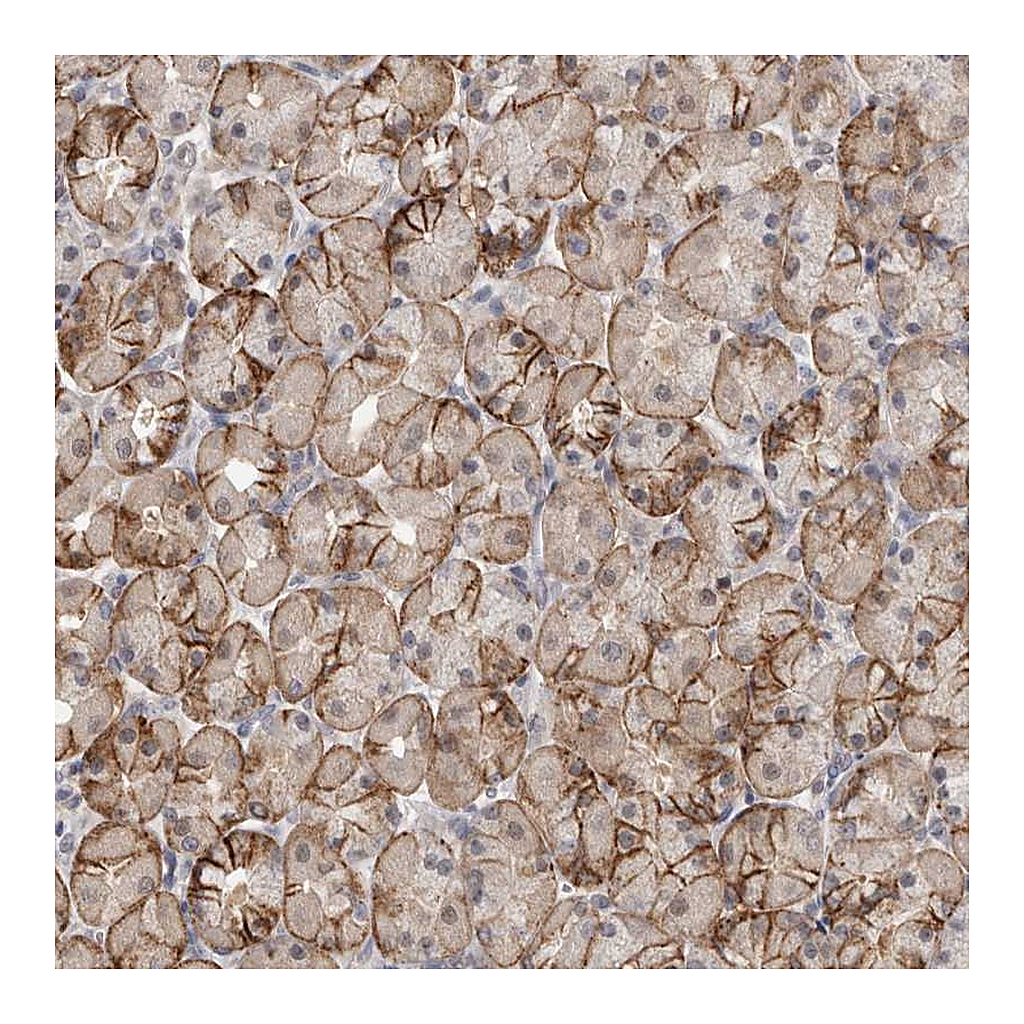 Atlas Antibodies Anti-PIGP Antibody