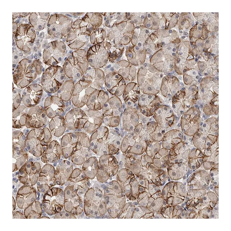 Atlas Antibodies Anti-PIGP Antibody