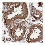 Atlas Antibodies Anti-PIGN Antibody