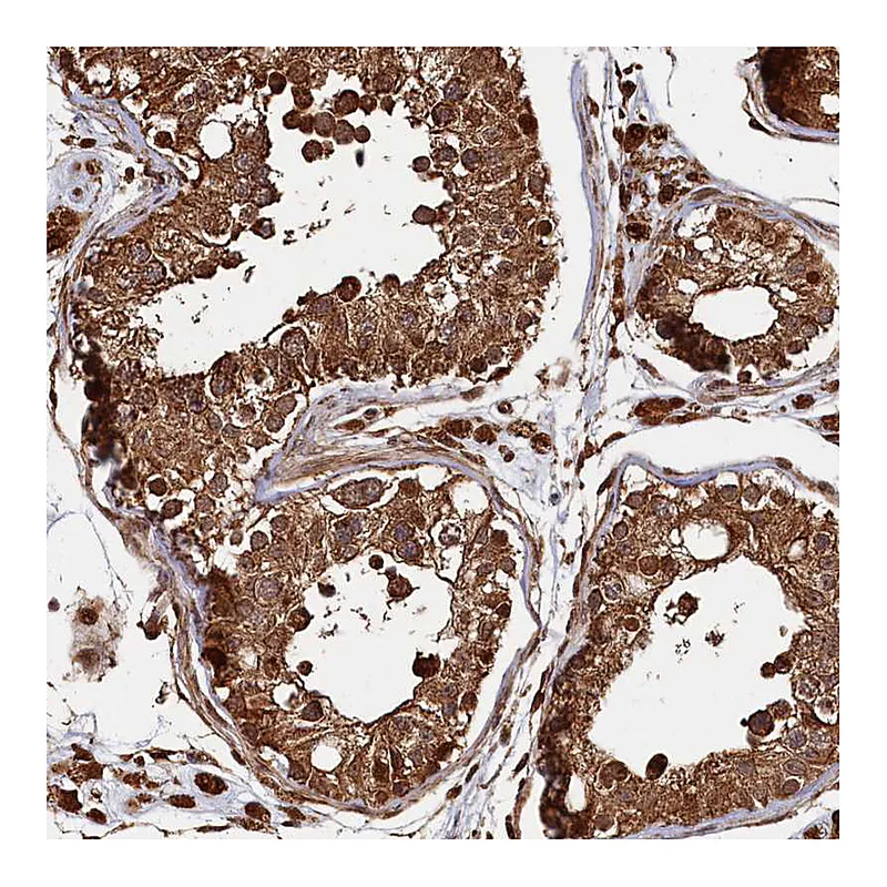 Atlas Antibodies Anti-PIGN Antibody