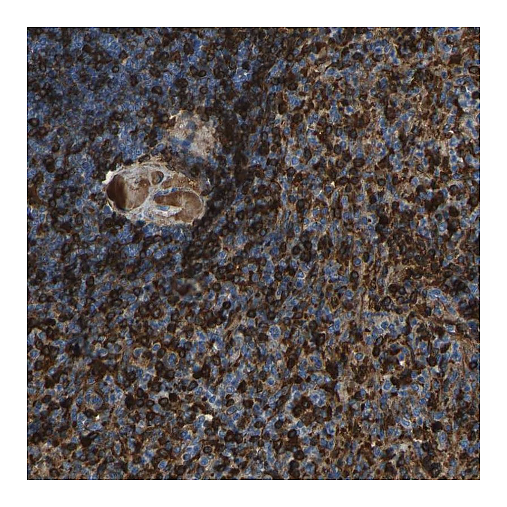 Atlas Antibodies Anti-PIGS Antibody