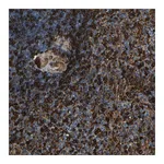 Atlas Antibodies Anti-PIGS Antibody