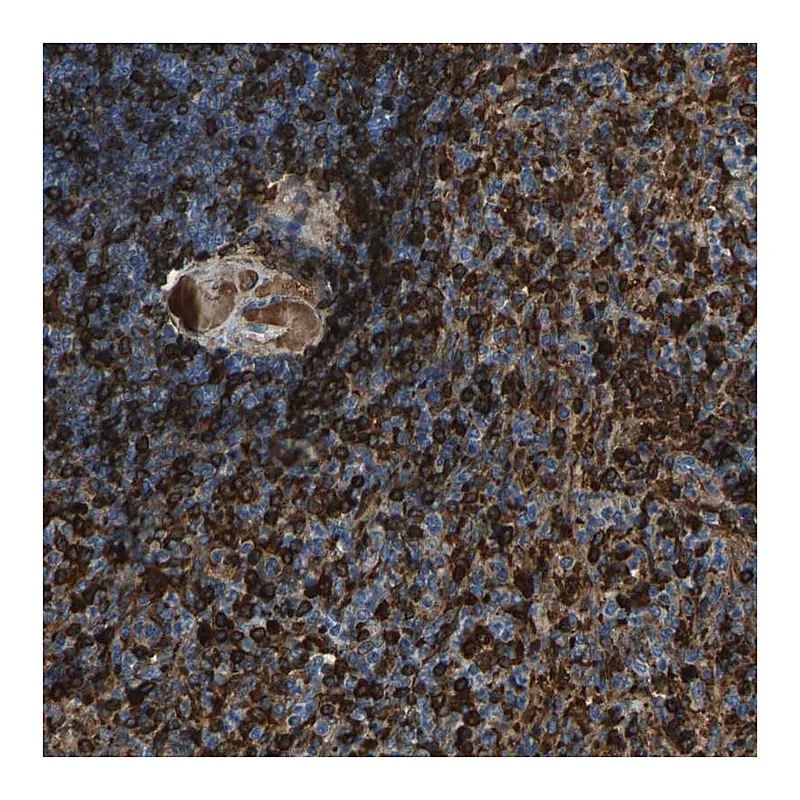 Atlas Antibodies Anti-PIGS Antibody