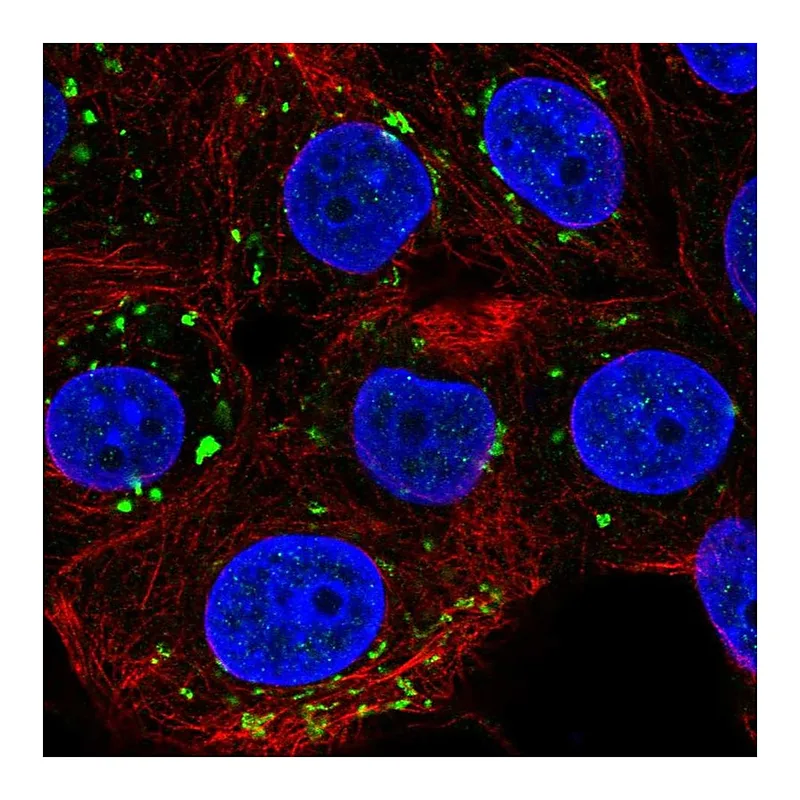 Atlas Antibodies Anti-PIGQ Antibody