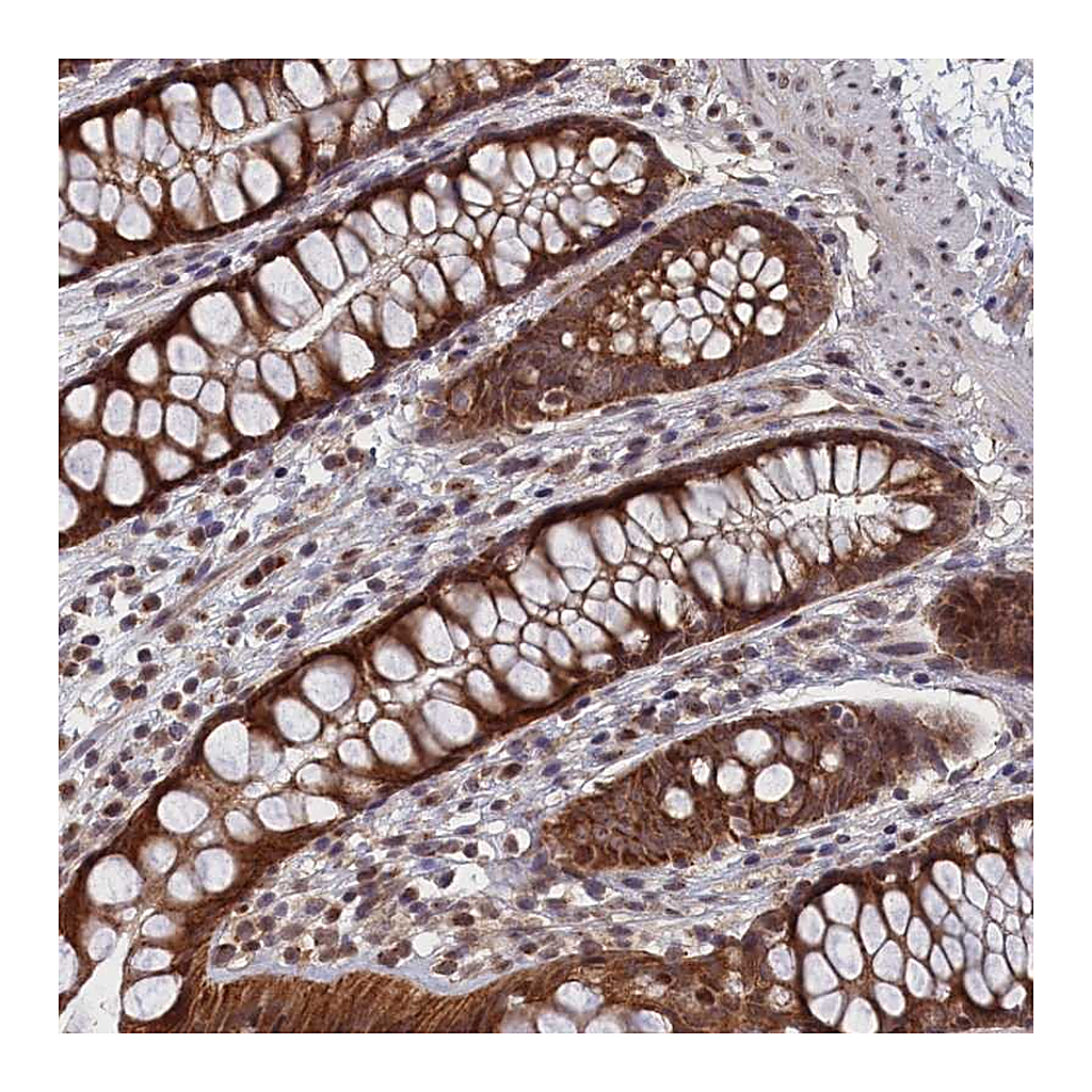 Atlas Antibodies Anti-PIGQ Antibody