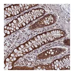 Atlas Antibodies Anti-PIGQ Antibody