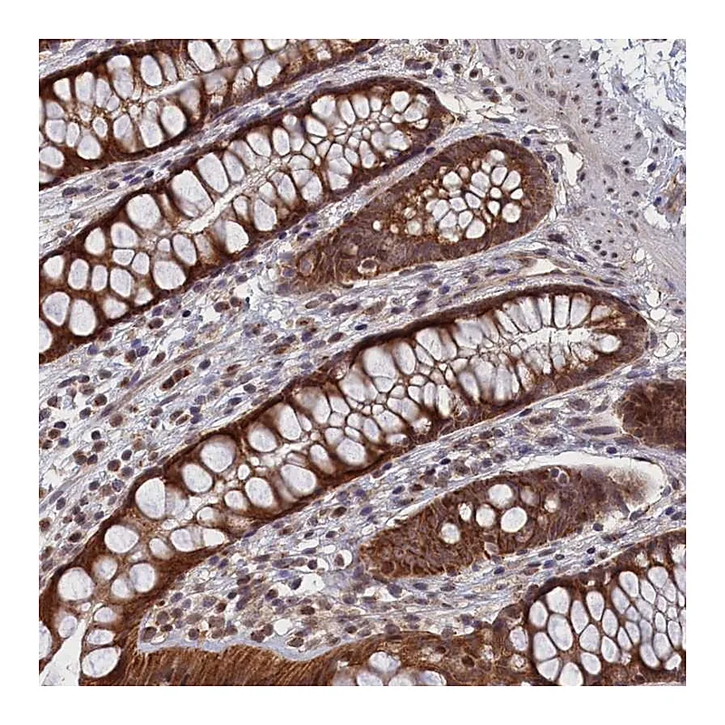 Atlas Antibodies Anti-PIGQ Antibody