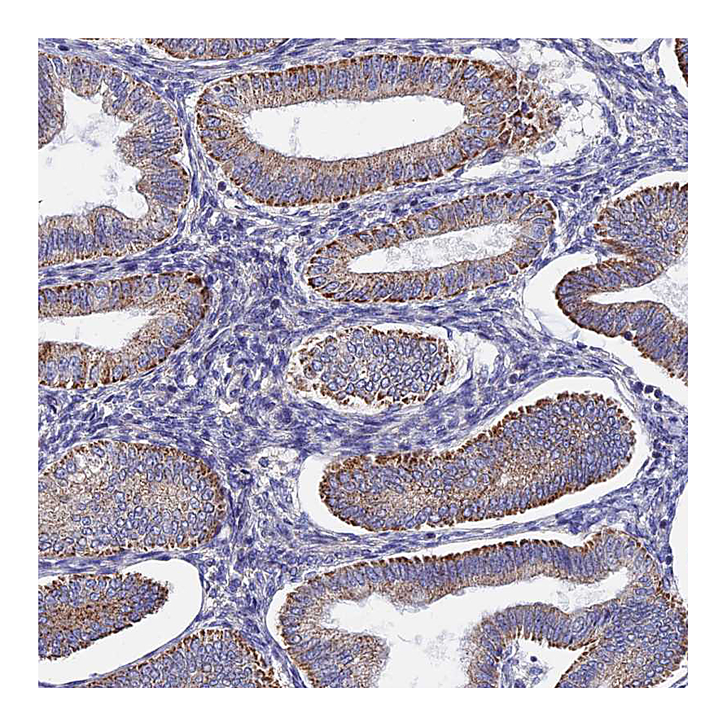 Atlas Antibodies Anti-PIGU Antibody