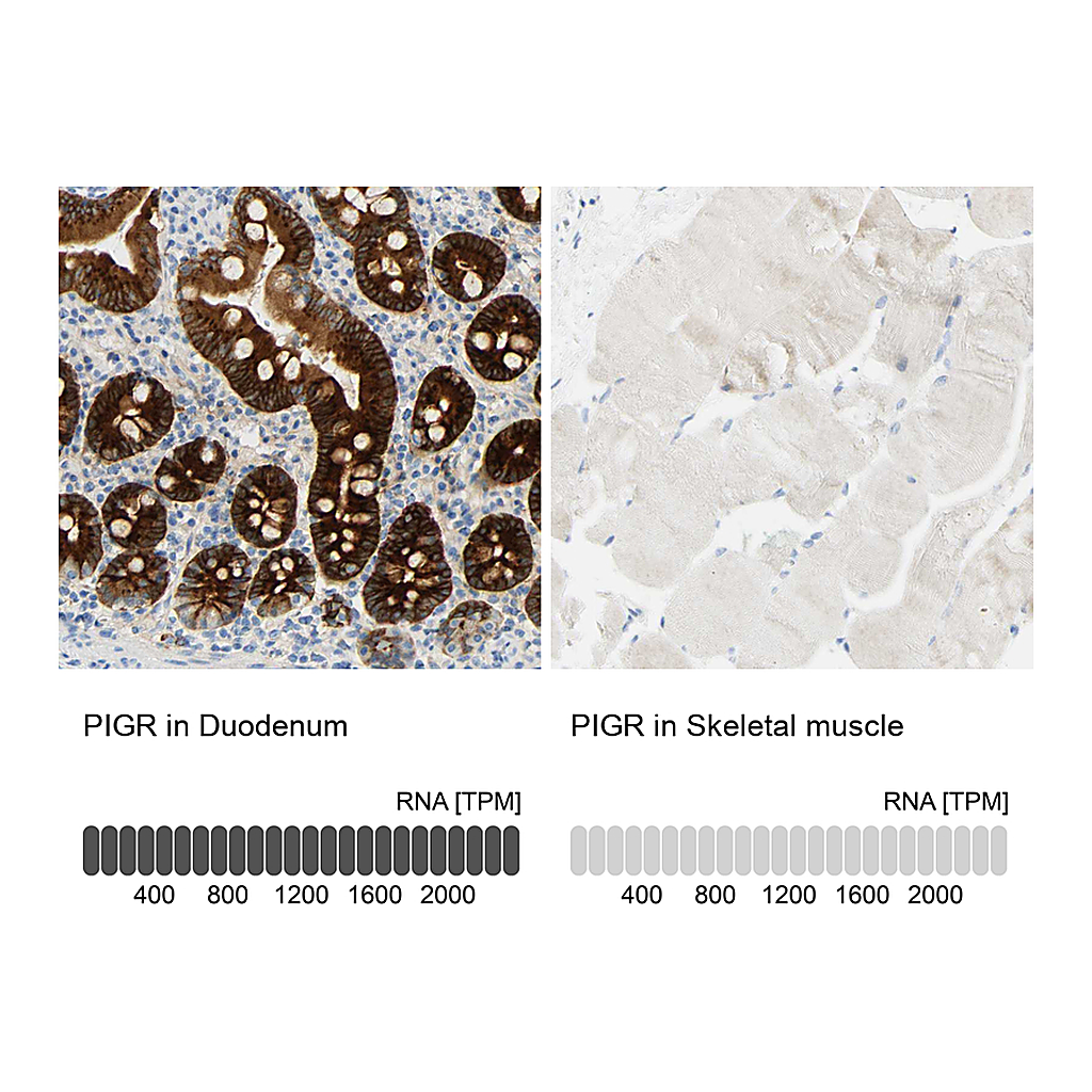 Atlas Antibodies Anti-PIGR Antibody