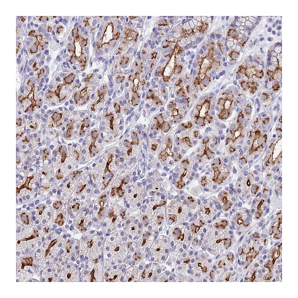 Atlas Antibodies Anti-PIGU Antibody