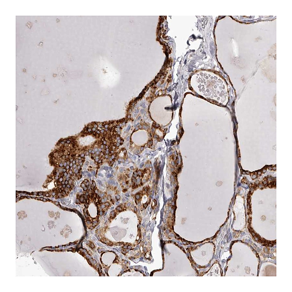 Atlas Antibodies Anti-PIGX Antibody