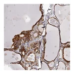 Atlas Antibodies Anti-PIGX Antibody