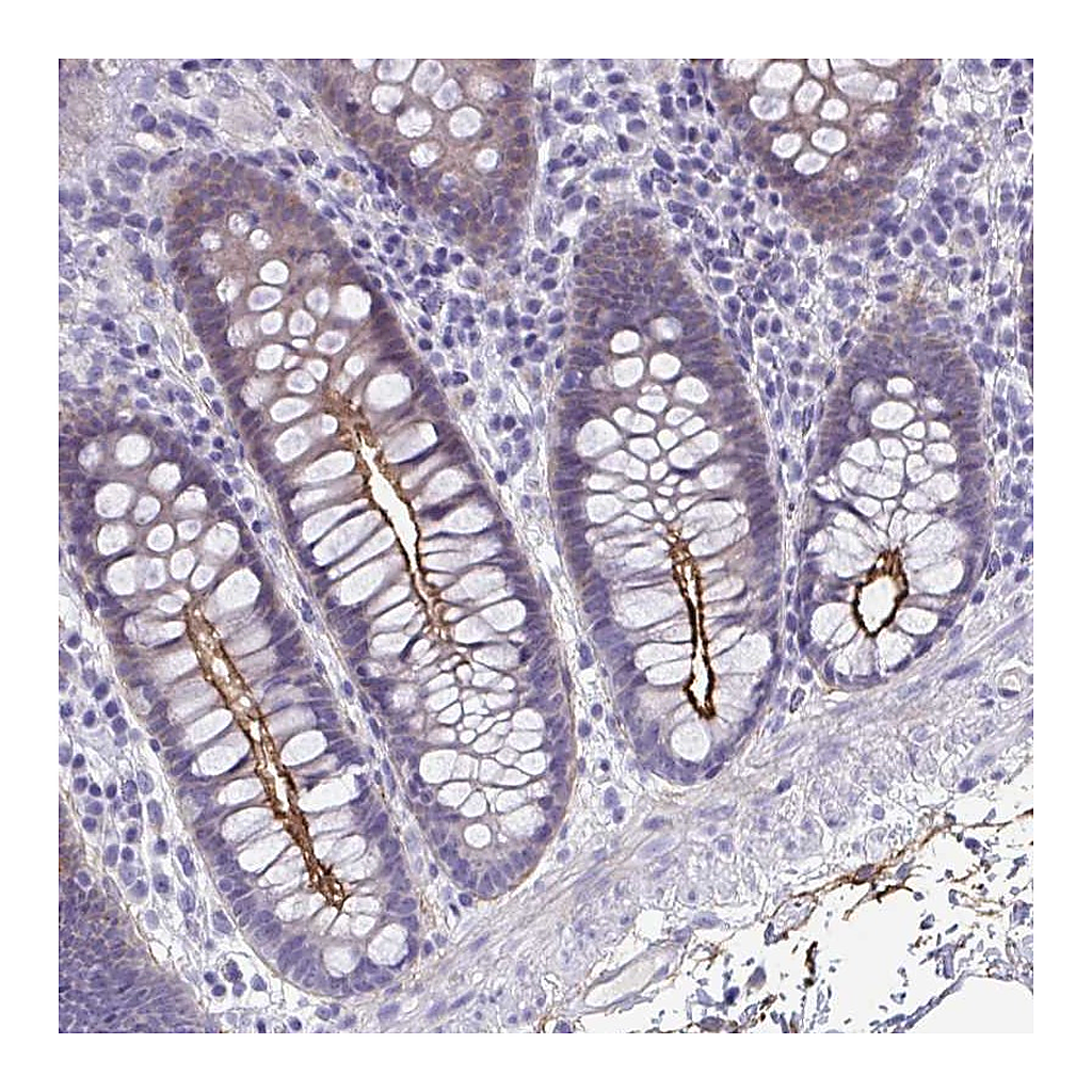 Atlas Antibodies Anti-PIGZ Antibody