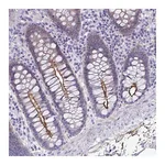 Atlas Antibodies Anti-PIGZ Antibody