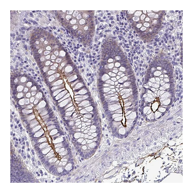 Atlas Antibodies Anti-PIGZ Antibody