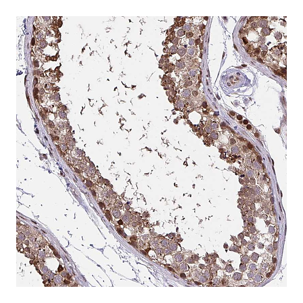 Atlas Antibodies Anti-PIGY Antibody