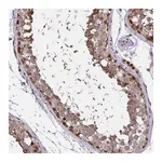 Atlas Antibodies Anti-PIGY Antibody