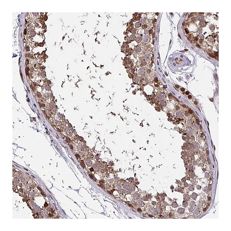 Atlas Antibodies Anti-PIGY Antibody