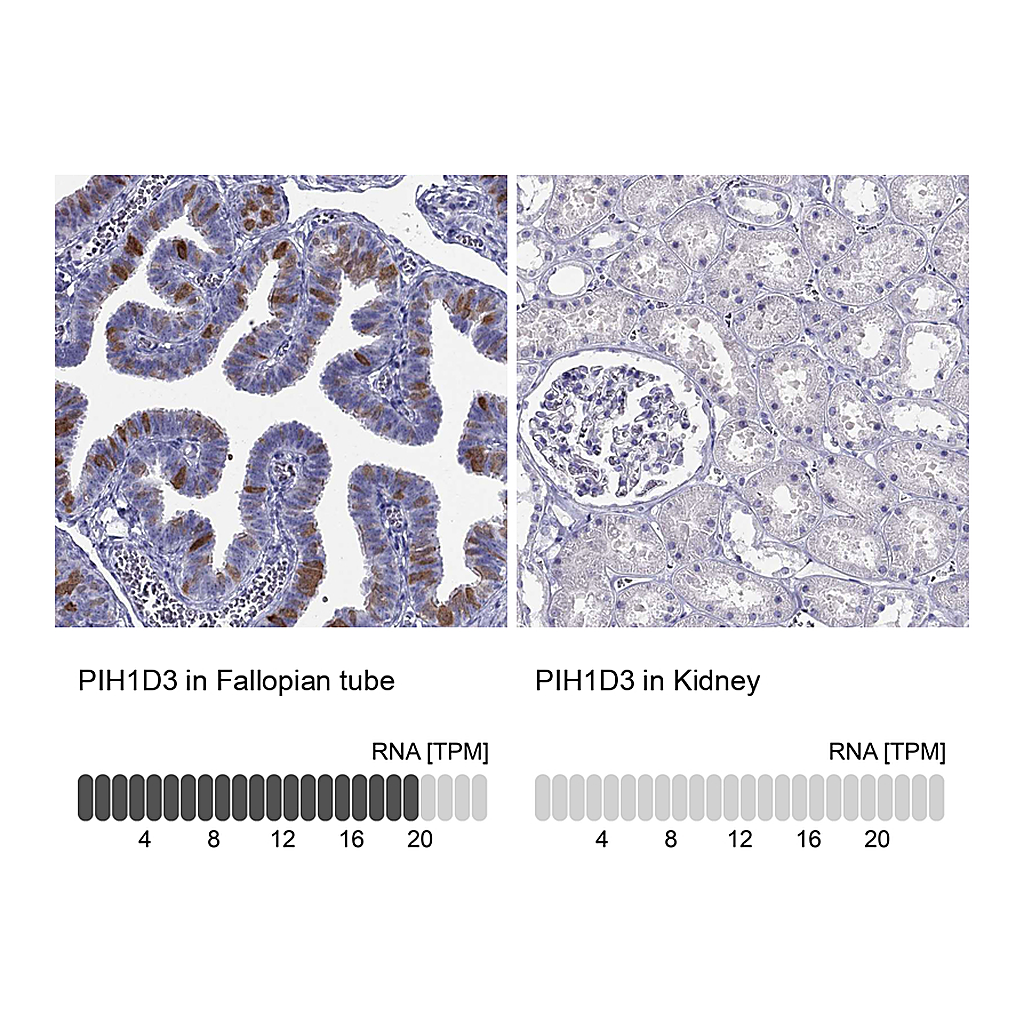 Atlas Antibodies Anti-PIH1D3 Antibody